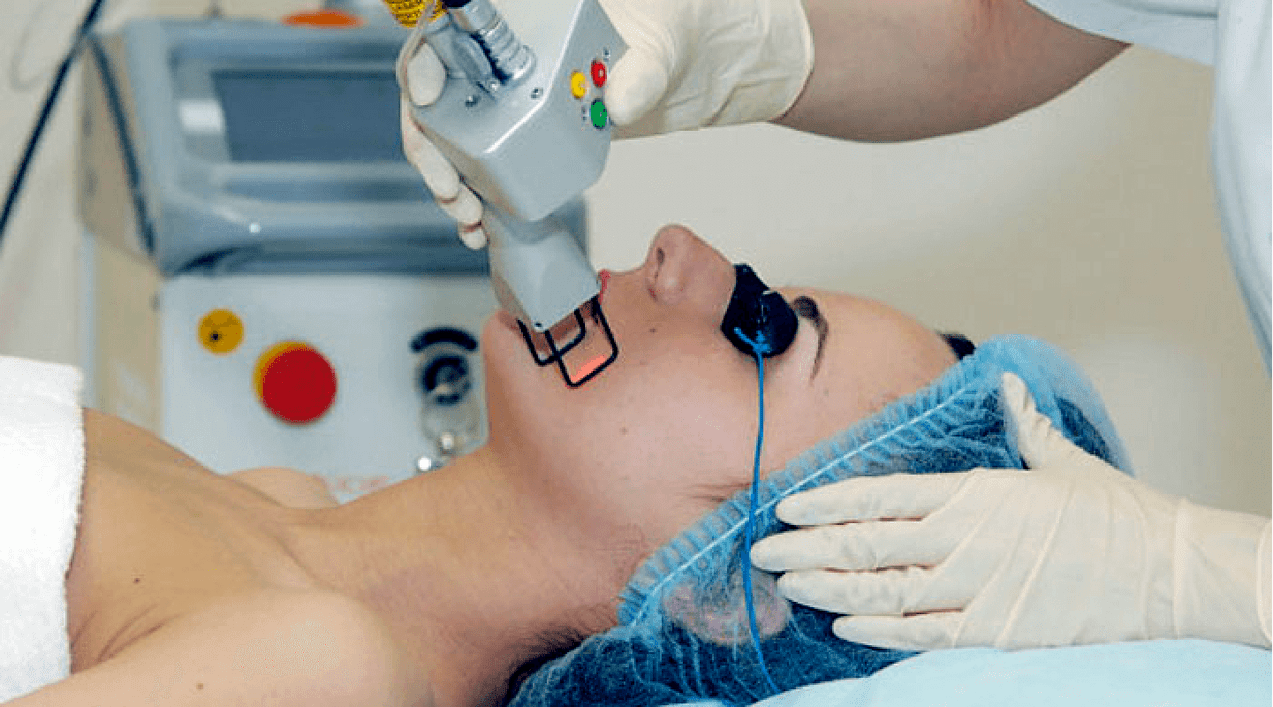 Laser fata rejuvenation hanya